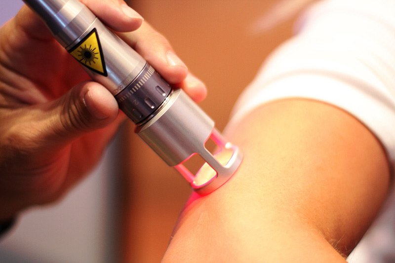 Laser therapy on person's elbow